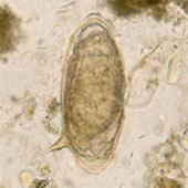 Genoma <i>Schistosoma mansoni</i>