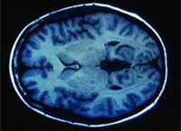 FAPESP e FAPEMIG divulgam resultado de chamada em neurociências